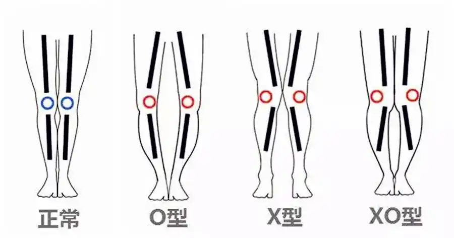 自查自己腿型,男人须知按腿型选裤子