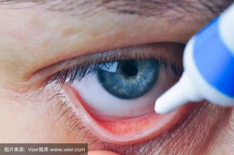 滴眼药水或眼药膏.