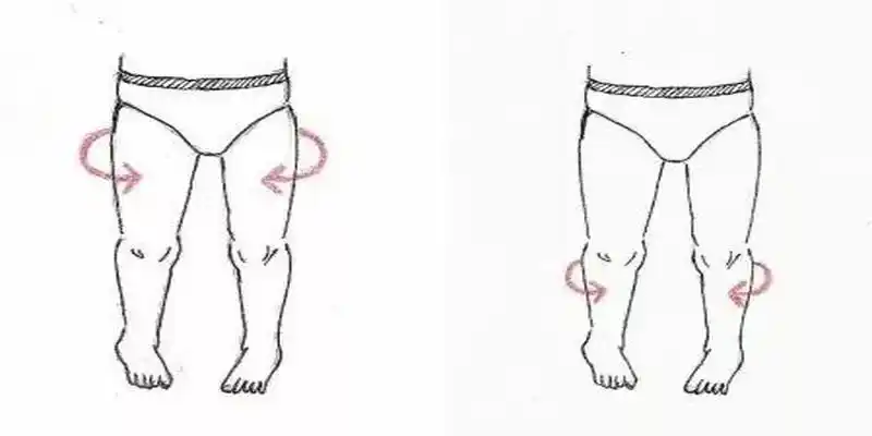 8岁小孩走路内八字怎么纠正孩子走路内八