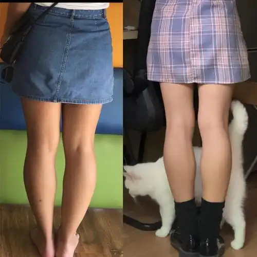 深夜睡不着,姐妹进来帮我看看这小腿