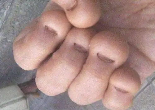 小时候爱「咬指甲」的孩子,10年后是什麼模样?背后2种原因引深思