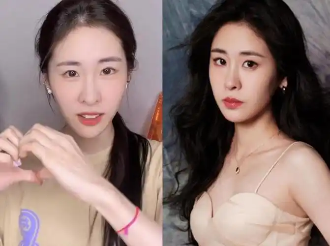 不过针对整容的说法,张碧晨在2021年曾否认,声称自己在韩国时期并没有