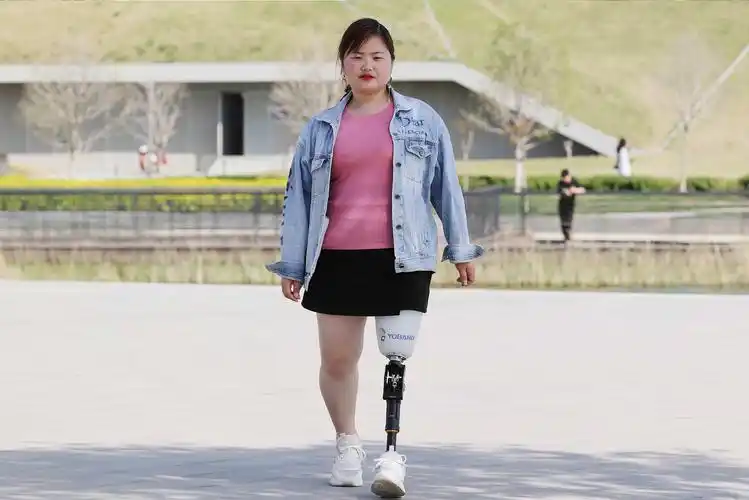 行业新闻 - 优邦假肢矫形器(上海)有限公司