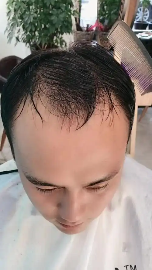 还在为秃鬓角上火吗?看这款发型