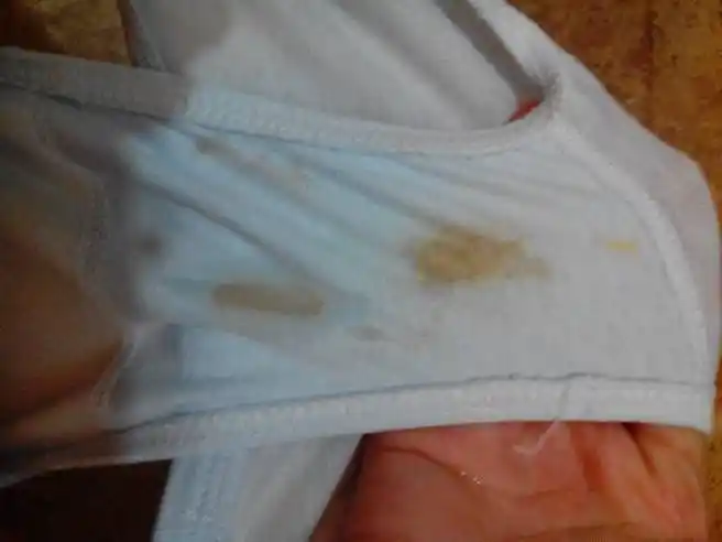 内裤上老是有这个色的分泌物,是不是流产的症状,怎么办?