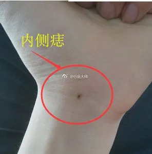 手腕的内外痣分别代表着什么?手腕外侧有. 来自行运大师 - 微博
