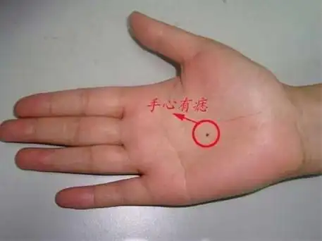 有些痣在面相学中就是福痣,长着它的人必定成大器.