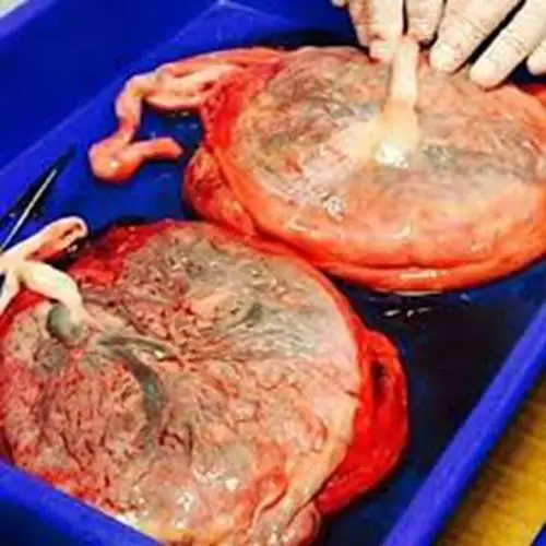 人胎盘详细的特征图片