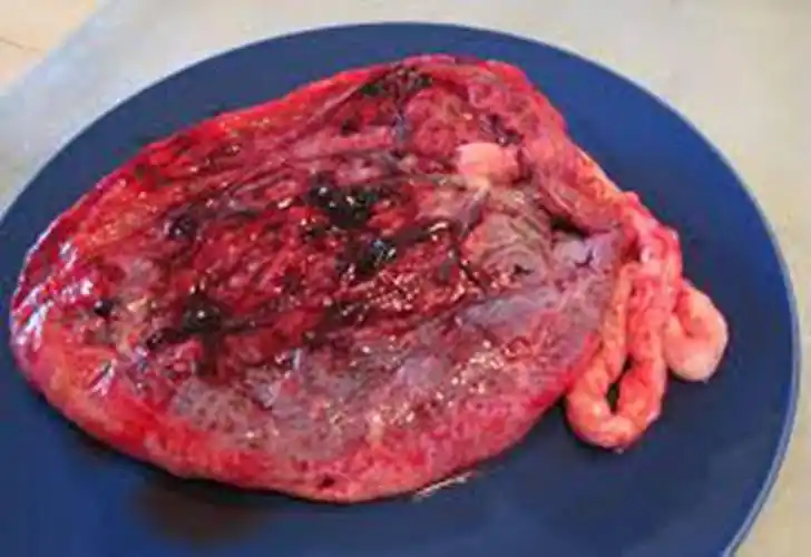 人胎盘详细的特征图片