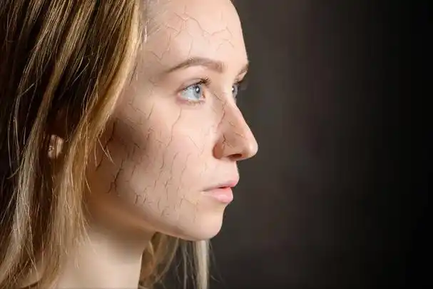 皮肤缺水怎么办?教你5个方法,让你的皮肤保湿?