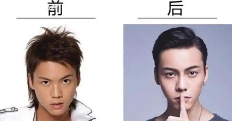 陈伟霆回应整容事件