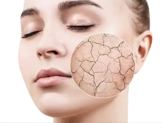 《美力日记108篇》第102篇—【解锁皮肤补水正确姿势】