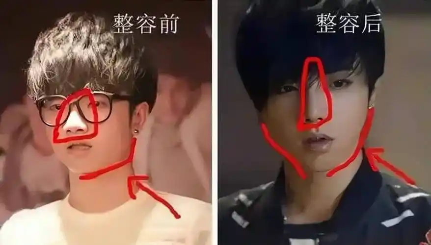 华晨宇"整容",跟出道前判若两人,还和邓紫棋,张碧晨纠缠不清_脸型