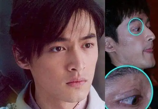 胡歌俞灏明他们从鬼门关走了一遭意外毁容坚强复出