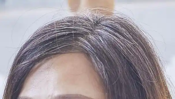 近年来,越来越多的年轻人出现了早白头发的现象,这让不少人感到惊讶和