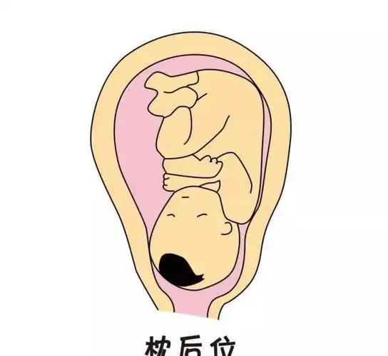 孕妈妈产检结果是头位的话,那么胎宝宝的头部就在下