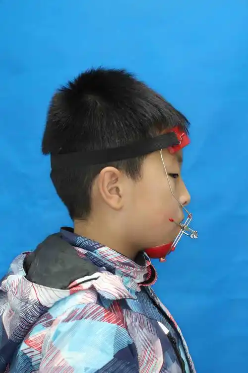 儿童牙齿矫正是否越早越好邢台宏皓口腔专家王静告诉您