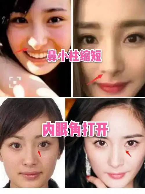 换头级选手之第二位——杨幂到底对自己do了啥?