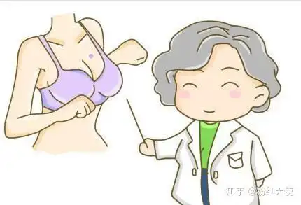 乳晕上长毛的女性要注意