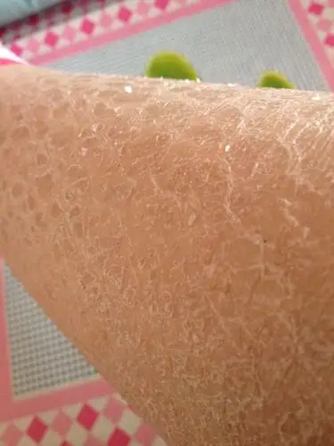 皮肤干燥像鱼鳞一样冬日粗糙掉皮夏日