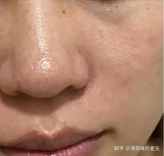 熬夜带娃皮肤状态差怎么改善从宝妈到辣妈我支楞起来了