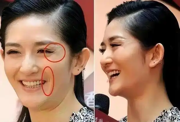 明星不化妆和普通人有哪些区别?其实差距还不小,看了就知道了