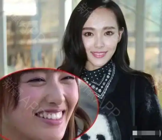 15组明星牙齿矫正前后对比图 效果堪比整容!