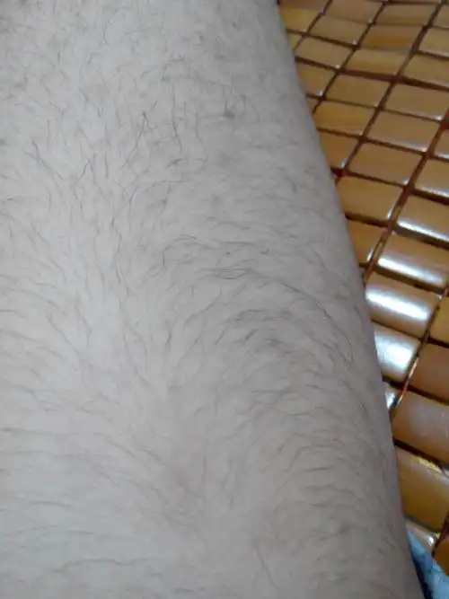 15岁男 腿毛这么长正常吗 好自卑啊