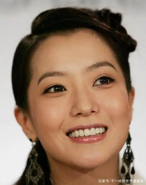 整形手术后遗症吓人,金喜善脸部僵硬到嘴巴