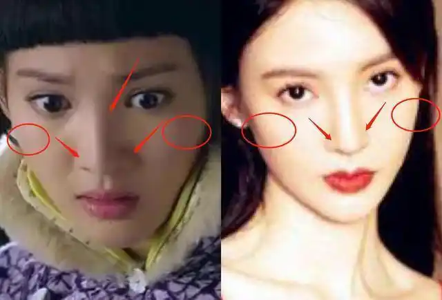 金晨节目中也翻车了旧照被扒鼻大脸宽没山根被网友质疑整过容