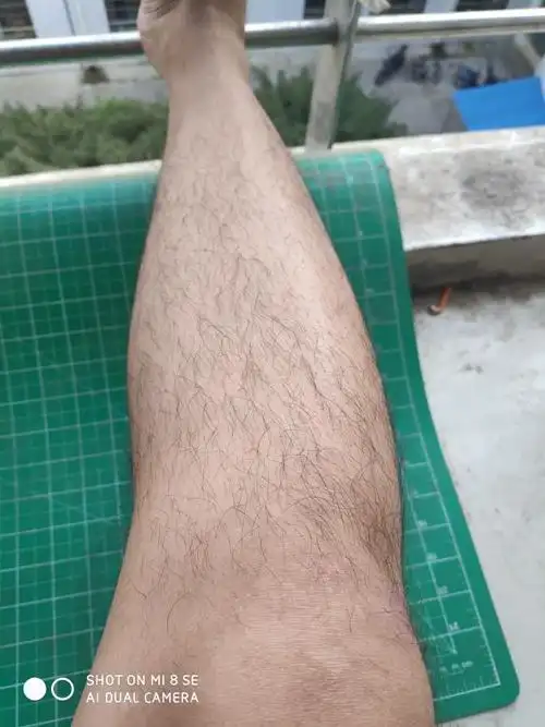 这样的腿毛算多吗?