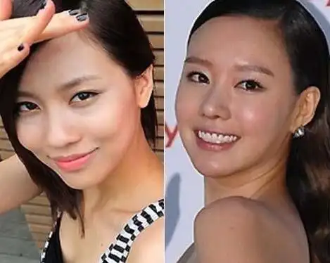 图王霏霏整容了吗王霏霏整容前后对比照