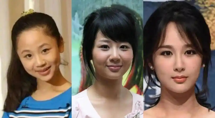 杨紫面部僵硬,因"科技脸"再被嘲 妥妥的整容后遗症_网友_时间_自然