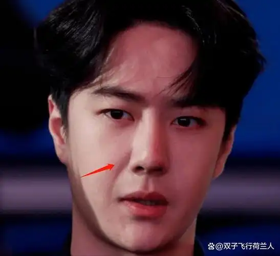 王一博新剧状态堪忧整容后遗症明显年代戏镜头里全暴露