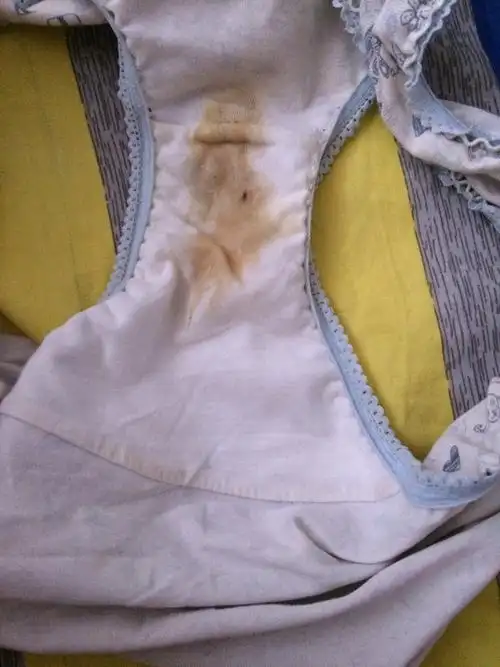 孕妈们你们是这样的情况吗?我孕六个多月分泌物多 烦死了 有图