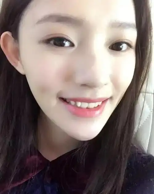 女星颜值速报林允的虎牙也太神奇了不标准还有个名字叫特色