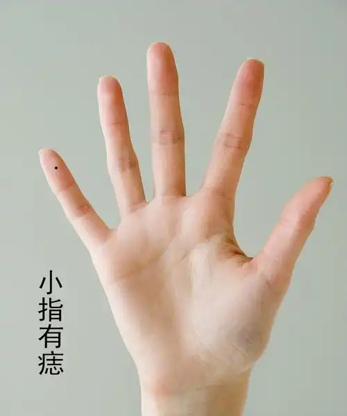 小指有痣的人,待人热情和善,性格也是非常善良的,乐于助人.