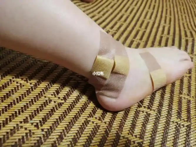 没有什么是一个创可贴不能搞定的,如果有就是需要两个三个创口贴,你家