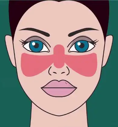 红斑狼疮尤其偏爱这样的女性,身体出现几种异常要小心!