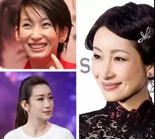 南方有乔木秦海璐现在这么漂亮都是整的