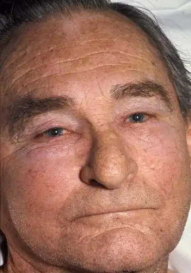 你的脸为什么这么大?