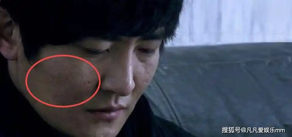 40岁郭京飞承认整容?但除了眼袋,另外三处也被质疑