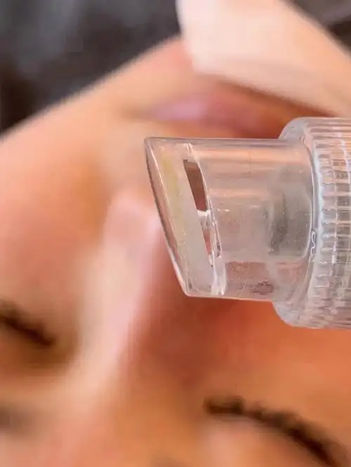 小气泡清洁黑头流程详细安排