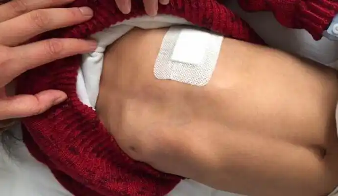 佝偻病的早期症状 (38)