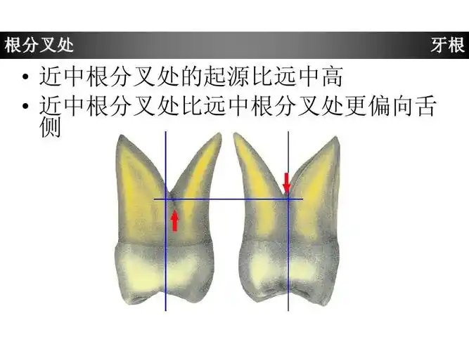 上颌第一磨牙牙体形态简述ppt