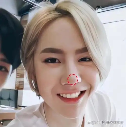 整形医生:还有人说王一博动过脸,给他看这篇就够了