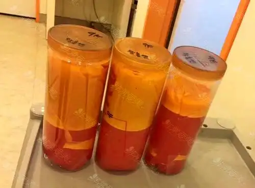 在韩国365mc医院抽出来的脂肪