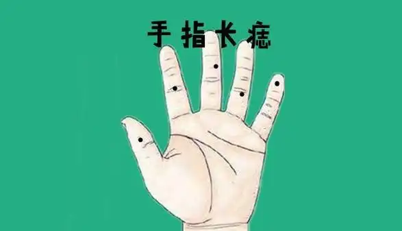 手指长痣在痣相学中,若是一个人的手指的位置长有吉痣,被称之为贵人痣