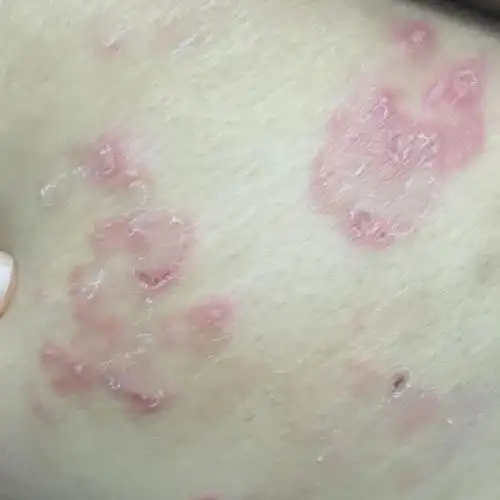 屁股反反复复这样子,到底怎么回事?