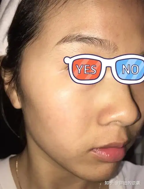 让你1个月,从脸色发黄暗沉的黄脸婆,逆袭白天鹅!